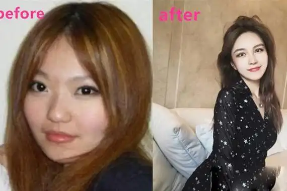 周扬青整容前的照片被扒买假包炫富究竟怎么回事