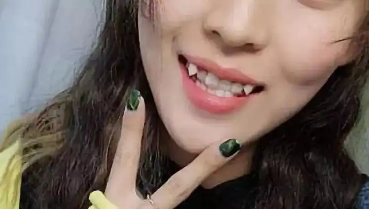 其实 虎牙还有这样的 ▼ 其实 龅牙还有这样的 ▼