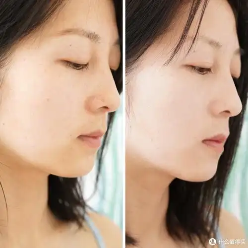 2,使用软水机前后背部皮肤状态下一组对比图是我使用软水机前和使用