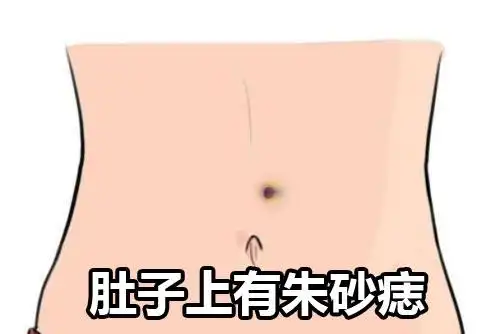 肚子上长朱砂痣的人命运好不好