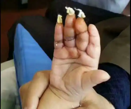 心疼!河南1岁女孩被亲妈剁掉3根手指头,你也常这样