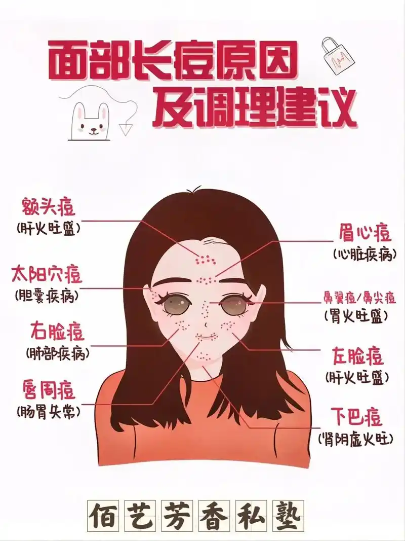 面部痘痘反射区代表的身体问题,对痘痘肌可以参考一下!#科普一 - 抖音