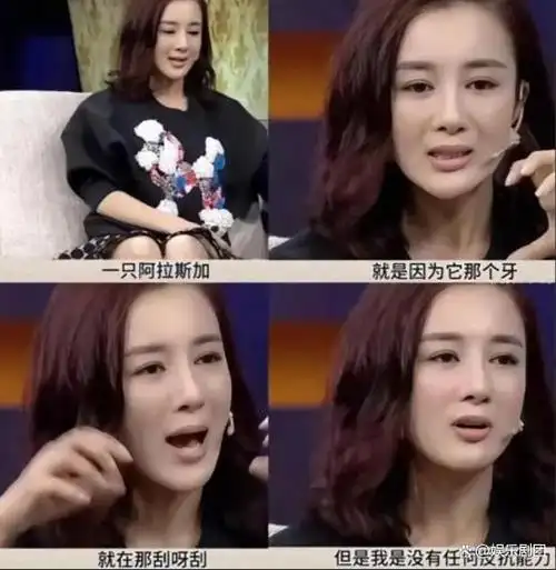 当年李依晓被叶璇爱宠咬到血肉模糊,狗主人叶璇为何胜诉?