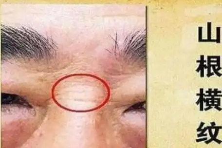 女性两眼间鼻梁有横纹面相好不好 山根有横纹的女人命运如何