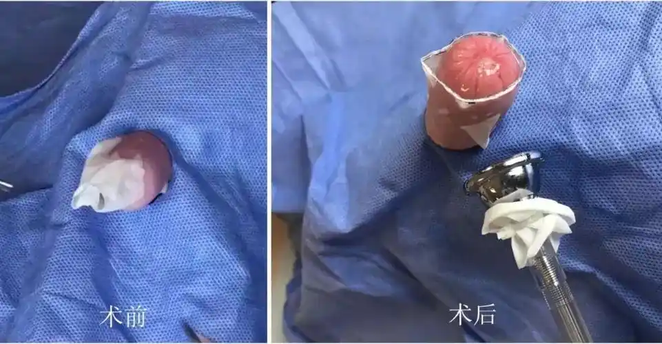 小弟弟,听听医生怎么说._手术