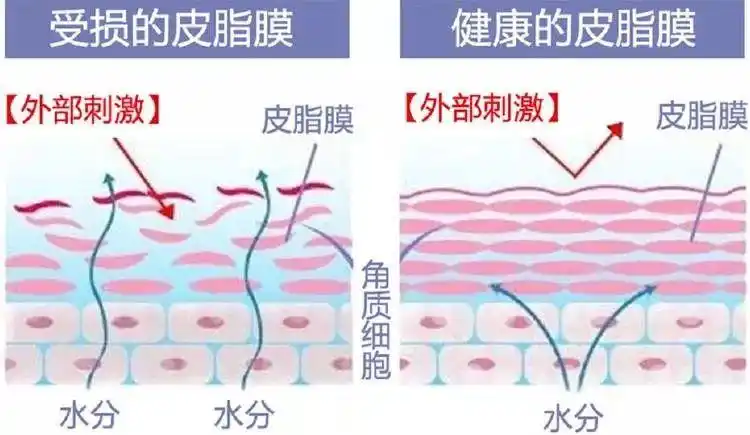 皮肤管理丨走进皮脂膜的世界