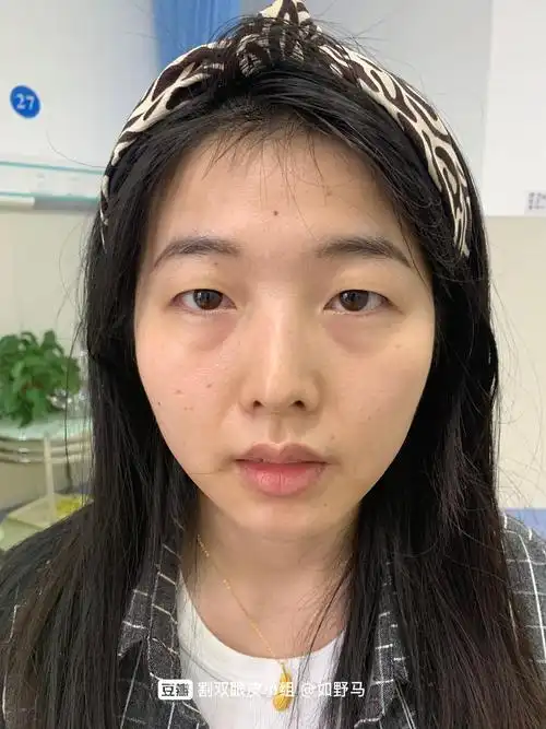 素颜正面(略仰拍)