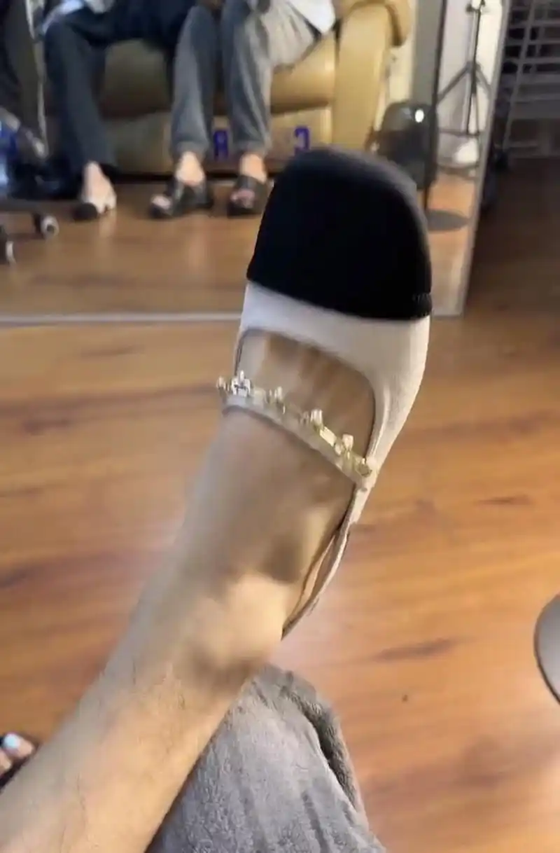 有学医的朋友看一下,女生腿毛那么多,正常吗?[开心]