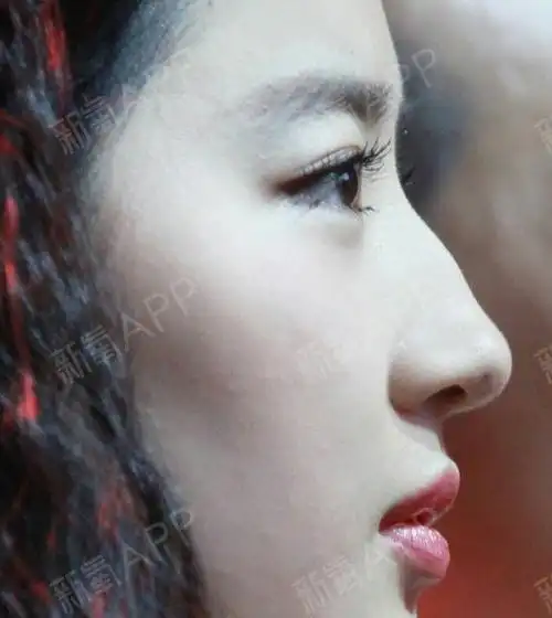 但是我们不难发现,身边许多有驼峰鼻的人并不是那么好看,侧脸甚至有点