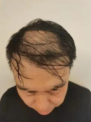 深圳极客补发店在哪里内含地址