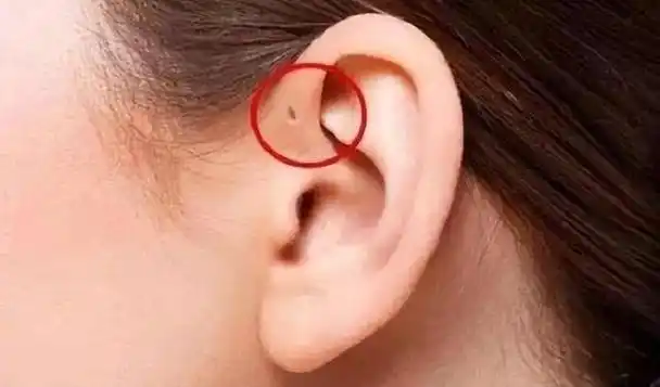 "穷人耳""富人耳"究竟有没有科学依据?耳朵的种类又有多少?