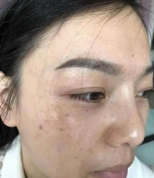 西红柿与它搭配美白淡斑又嫩肤坚持两周皮肤又白又水润