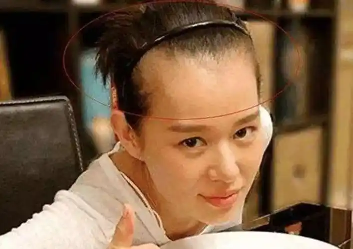 娱乐圈哪些女明星的发际线超出了你的想象