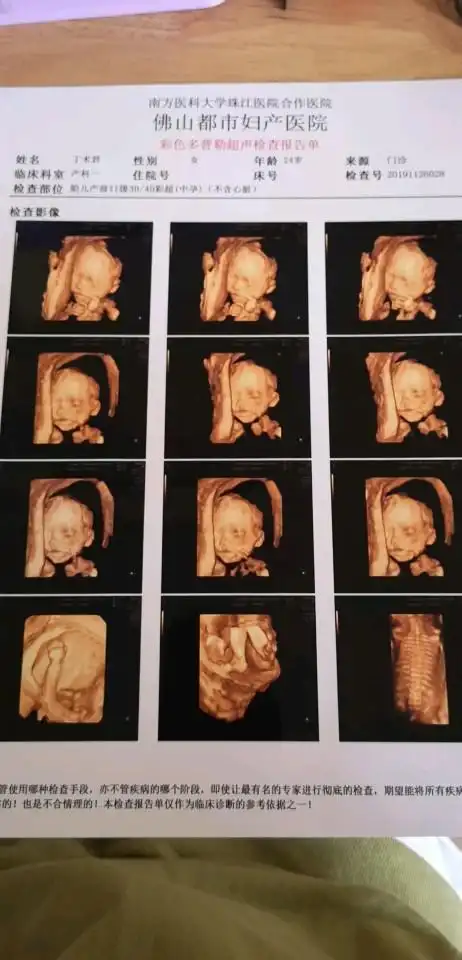 四维彩超图片,朋友们看看是女孩子是男孩子