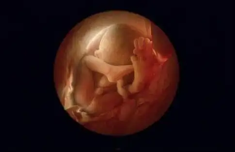 做四维时,大夫常说的这几句"暗语"男孩女孩,听不懂就亏大了