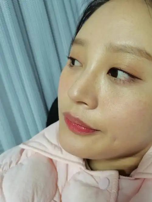 今天30岁这样的皮肤状态算可以还是差