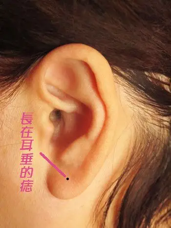 耳朵的痣代表意义