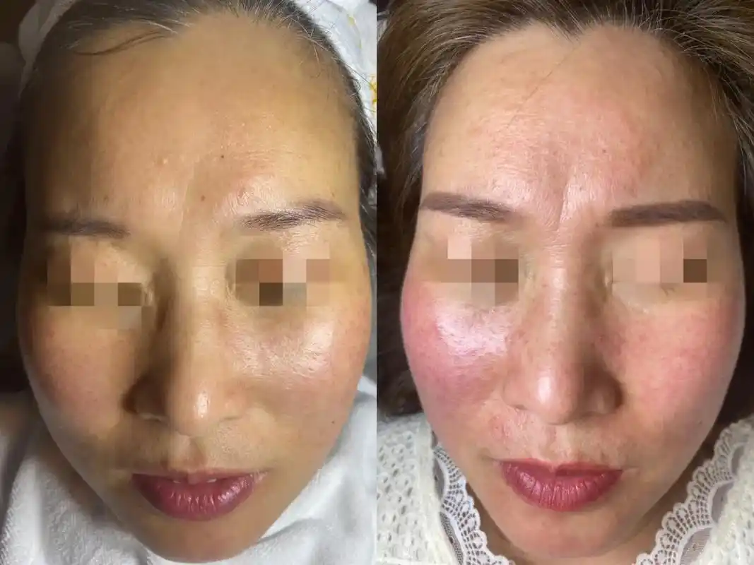 问题性皮肤管理 #告别肌肤 - 抖音