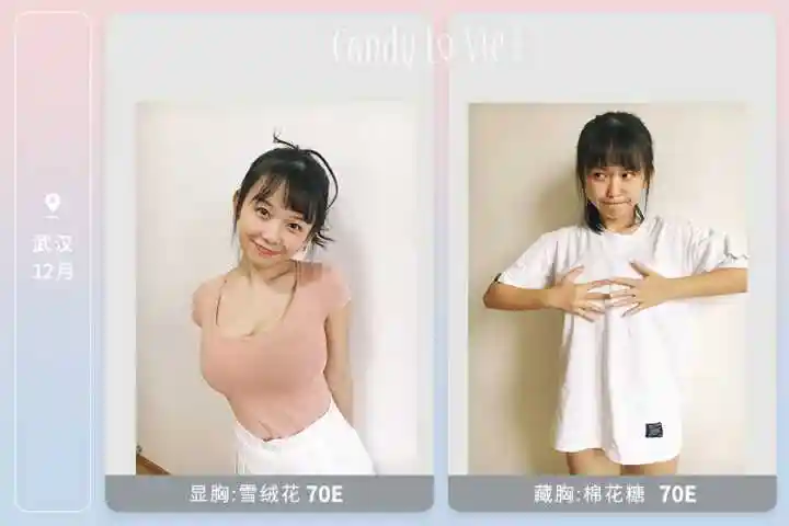 清楚是否会采用"真皮帽"技术 不过以妹子的罩杯来看根本不需要手术