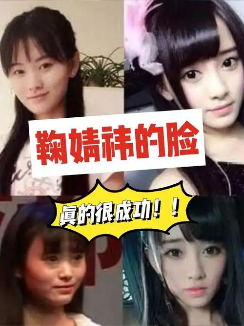 相信每一个看过鞠婧祎早期出道的照片和现在照片作对比_圈子-新氧美容