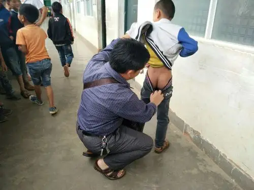 干河小学皮肤健康体检