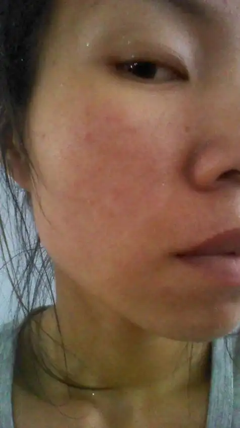 清洁完面部也要涂润肤液的秋冬2季皮肤会很干燥