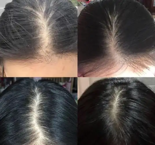 亲测有效的生发好物!一个月头发蹭蹭往出冒,国产就是牛!-cw资讯网