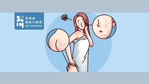 杨希川教授-皮肤科医生