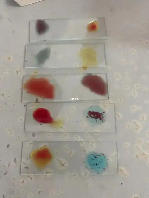 玻片凝集实验测血型大家来猜猜这些都是什么血型叭#血型与性格