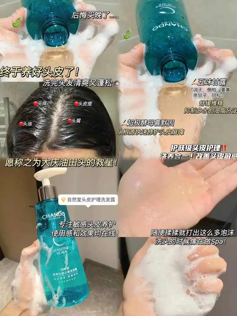 甩开头皮痒长痘痘!用完你都不想换.头皮敏感的痛我真的能懂!  - 抖音