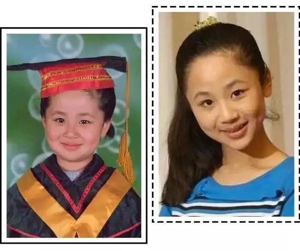 芽芽向大家发4, 杨紫的法令纹是天生的,小时候鼻翼两边的纹路就比一般