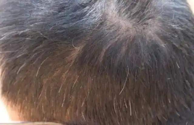 儿媳妇听到喊声过来看了一眼,确实头发中间有几根白头发:"还真的是有