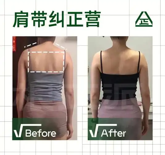 溜肩改善肩颈流畅上斜方肌终于小了