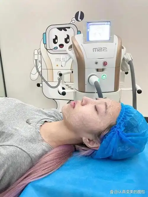 它利用特定的光谱脉冲光线来刺激皮肤表面坏死的角质层不断再生,达到