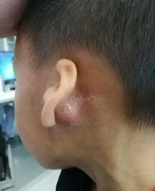 点退烧药,可是谁知道到了晚上9点,儿子竟然一直不肯睡觉,还反复抓耳朵