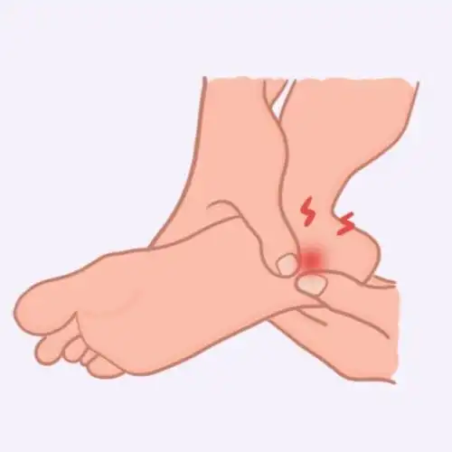 膝盖疼腿疼脚疼5种跑步损伤专家教你处理