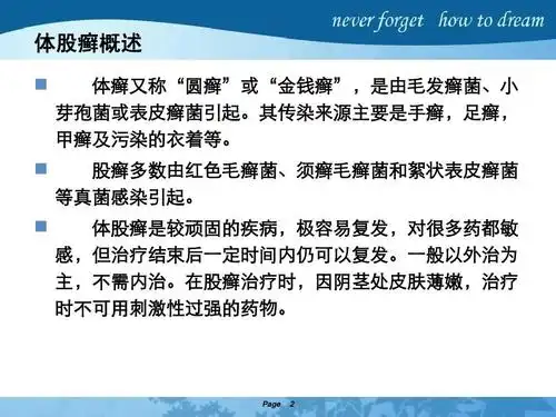 股癣最佳治疗方法?ppt