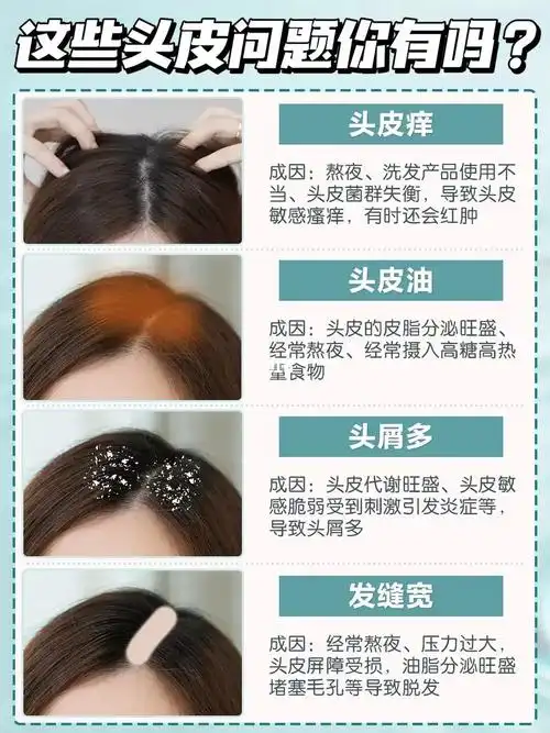 头皮敏感自测指南92附保姆级头皮护理教程