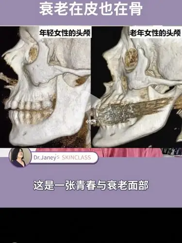 骨相和皮相的衰老