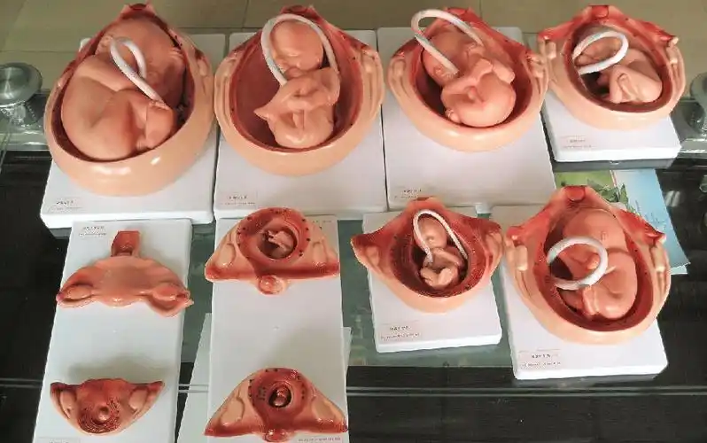 【科普在线】区分胎盘低置和前置胎盘_宫颈_教育_子宫