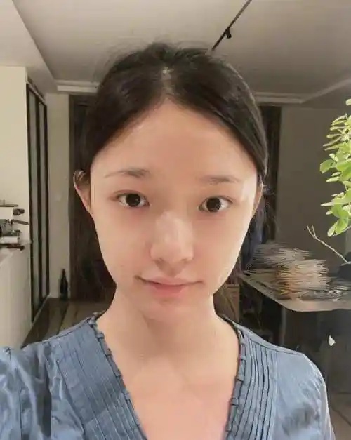 林允晒素颜自拍照皮肤水嫩有光泽却与妆后对比气质差别大