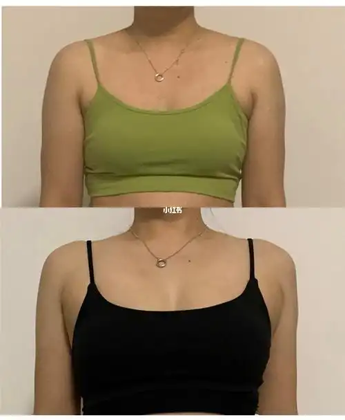 运动整容练胸前后对比