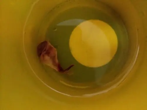 请问 自然流产流出这样的胚胎 这应该是多少天的样子