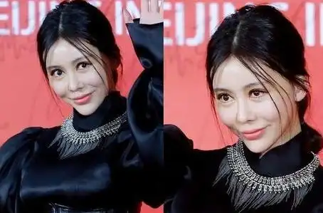 女明星整容失败的例子,这是在上演恐怖片?还是喜欢自然美!