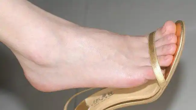 观察了半个月后毫无问题和不适感 自此脚丫美白任务全部完成 8月准备