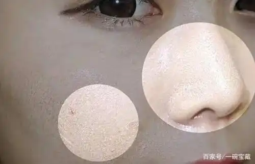 角质没去对,再贵的护肤品都是浪费!