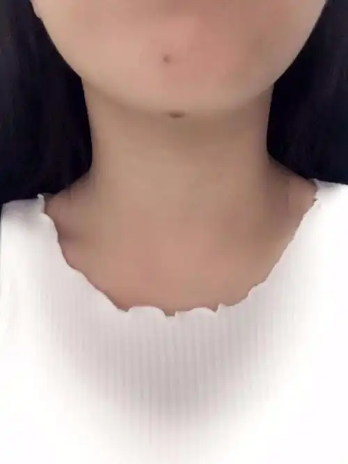 女人嘴下巴有痣好不好(女人嘴下巴有痣好不好图解)