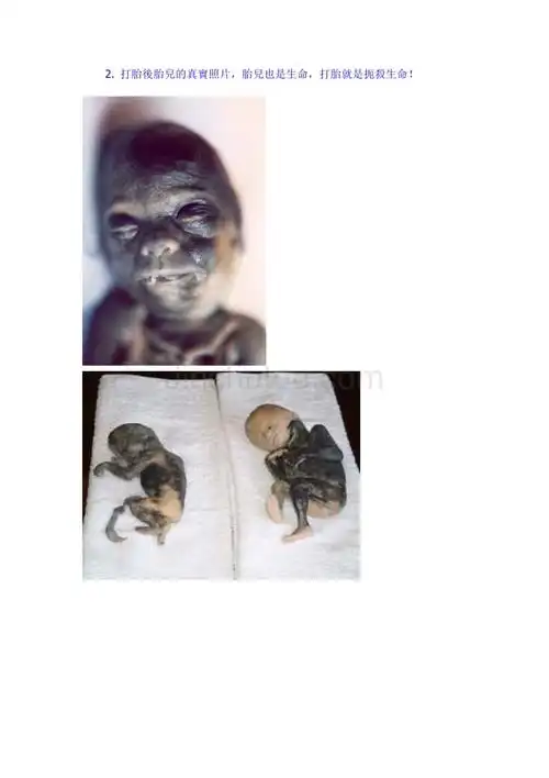 堕胎(残忍图片),作男人的都该看看