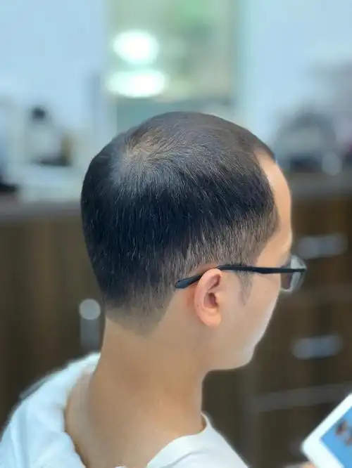 笔记灵感  #今日发型  #秃头  #我的发型  #男士穿搭  #我的日常