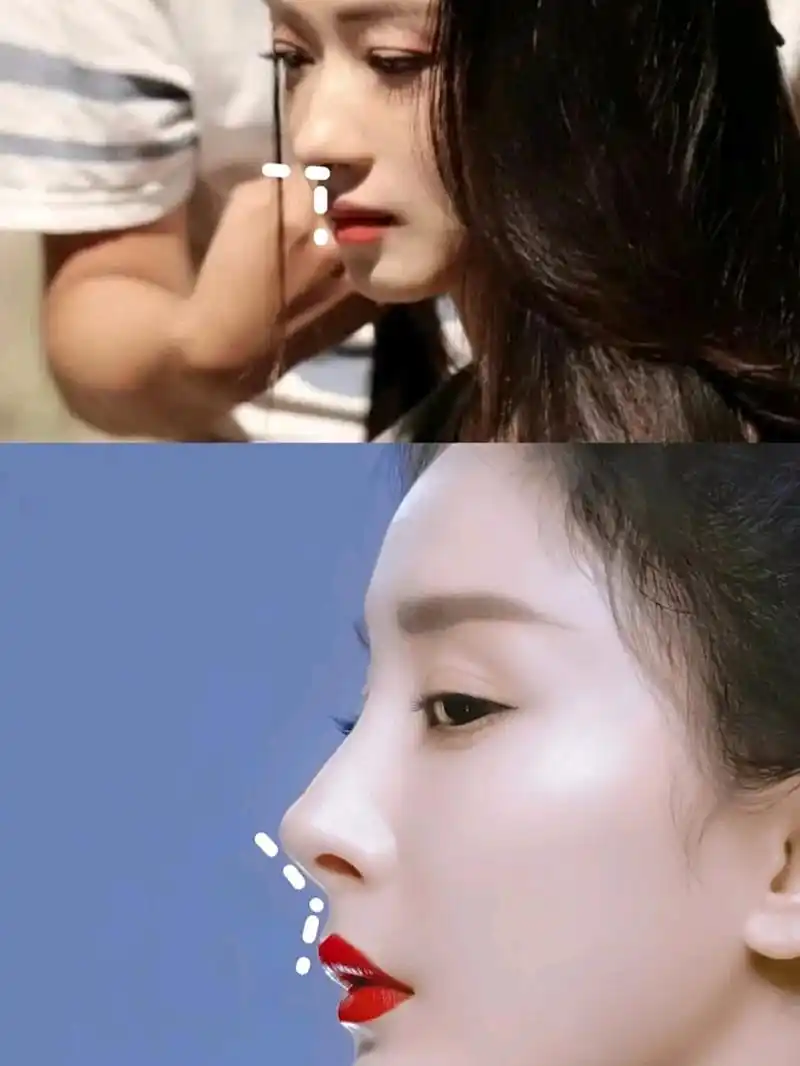 杨幂的鼻子为什么不好看?—隆鼻小细节